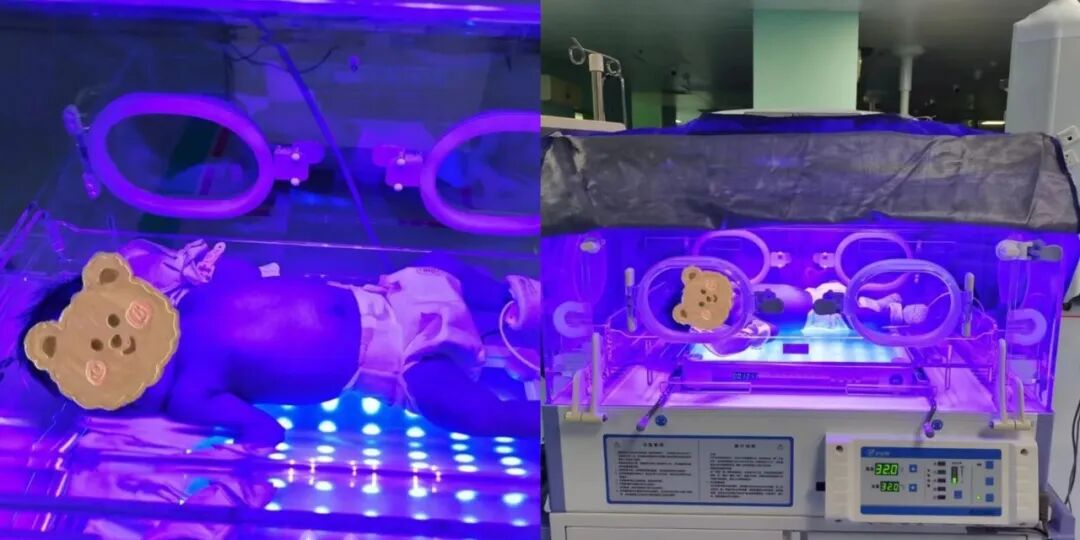 光疗时为什么黑眼罩【好消息】曲江妇幼新生儿科日间及夜间光疗门诊接诊啦，宝宝不用住院也能照蓝光！_https://www.jmylbn.com_新闻资讯_第8张