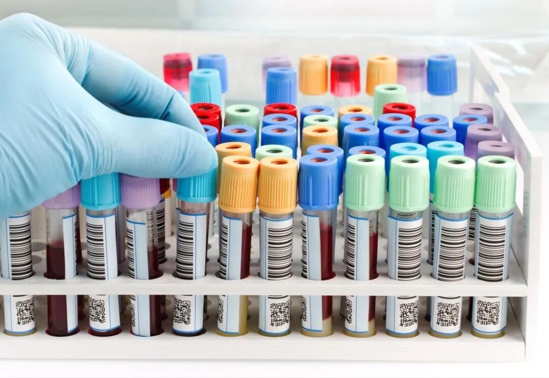 采血管颜色代表什么采血管为何五颜六色？每种颜色都是学问_https://www.jmylbn.com_新闻资讯_第2张