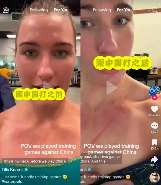 胸口全是血痕！中国女将晒照回应澳队员被抓伤：对抗项目，谁也别说谁