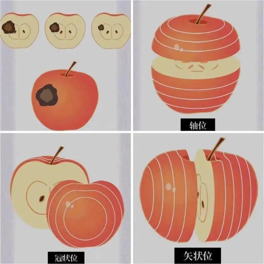 X光拍片为什么要等【围观】刚拍完X线，又让你拍CT，医生为什么要这样做_https://www.jmylbn.com_新闻资讯_第10张