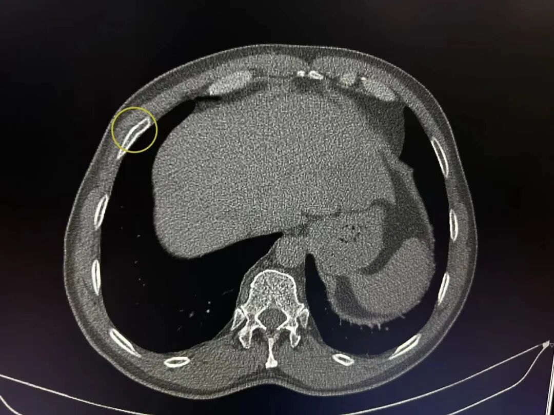 X光拍片为什么要等【围观】刚拍完X线，又让你拍CT，医生为什么要这样做_https://www.jmylbn.com_新闻资讯_第15张