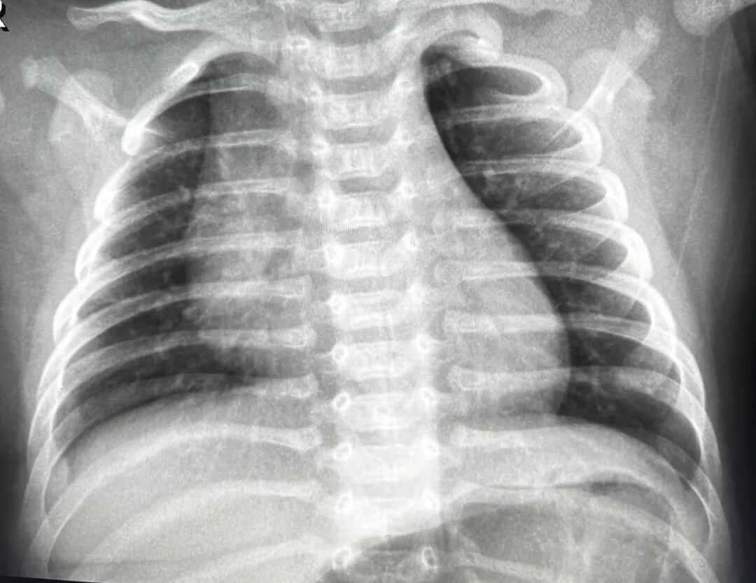 X光拍片为什么要等【围观】刚拍完X线，又让你拍CT，医生为什么要这样做_https://www.jmylbn.com_新闻资讯_第12张