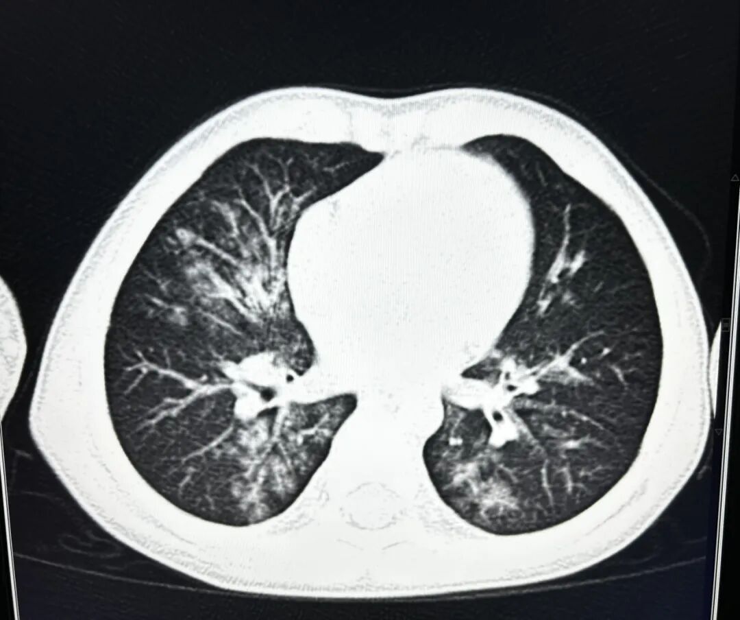 X光拍片为什么要等刚拍完X线，又让我拍CT，医生为什么要这样做_https://www.jmylbn.com_新闻资讯_第10张