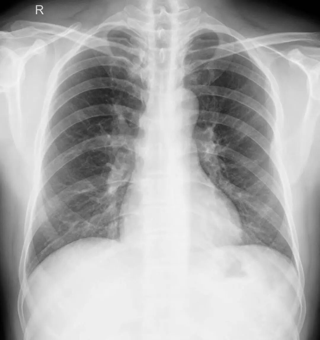 X光拍片为什么要等【围观】刚拍完X线，又让你拍CT，医生为什么要这样做_https://www.jmylbn.com_新闻资讯_第16张