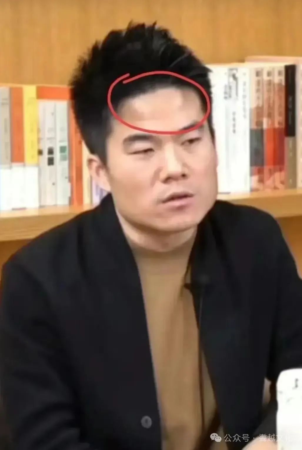 额头凸起像两个龙角_额头两边鼓起像龙角面相_额头两边突出像龙角面相