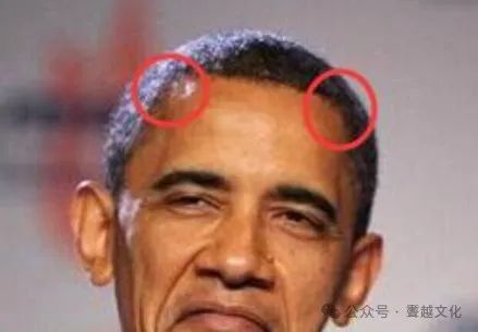 额头凸起像两个龙角_额头两边突出像龙角面相_额头两边鼓起像龙角面相