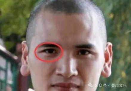 额头两边鼓起像龙角面相_额头凸起像两个龙角_额头两边突出像龙角面相