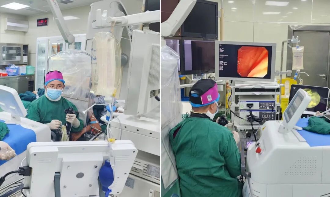 取石网篮 为什么贵【创新技术】ERCP+钬激光，联手“口中取石”_https://www.jmylbn.com_新闻资讯_第7张