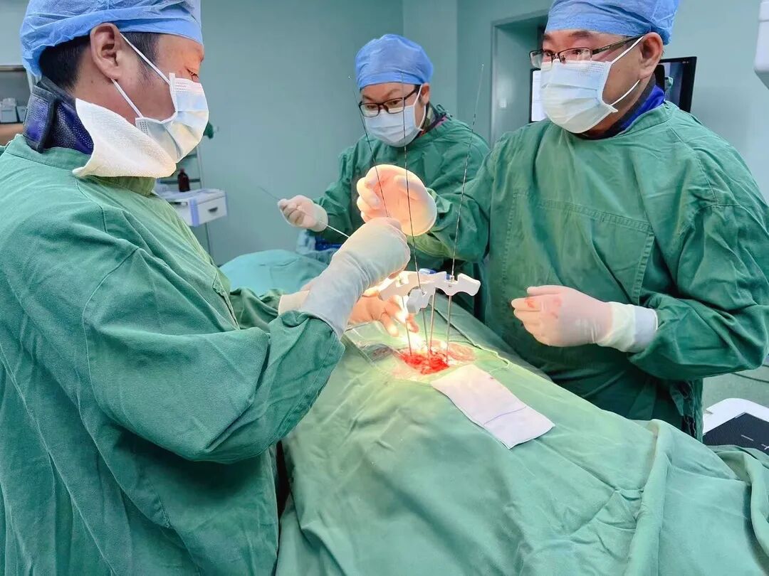 开刀孔怎么开刀胸椎骨折不需开刀，打4个“小孔”解除患者病痛_https://www.jmylbn.com_新闻资讯_第5张