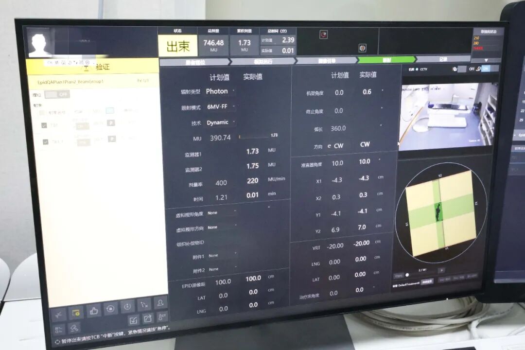 联影的CT怎么样精准“狙击”肿瘤细胞，新区中医医院顶级联影一体化CT直线加速器正式开机！_https://www.jmylbn.com_新闻资讯_第32张