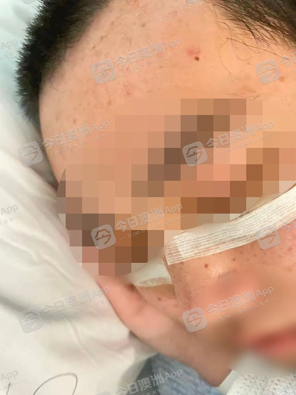 “是不是要死了？”中国留学生在澳遭青少年围殴，ICU抢救“捡回一条命”！华社愤慨组织集会，吁严惩未成年人犯罪（组图） - 4