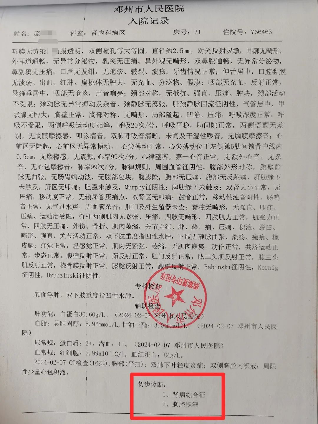 邓州市人民医院出具的病历资料显示:入院诊断为肾病综合征,胸腔积液