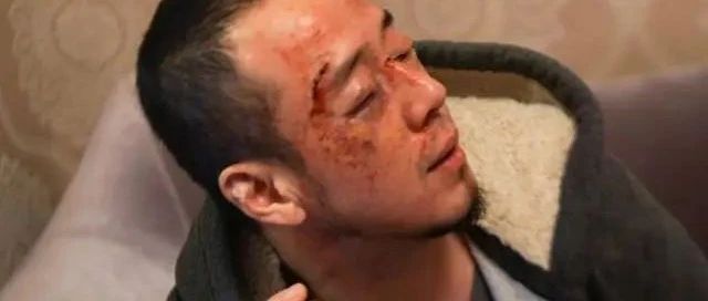 杨坤被打?警方回应