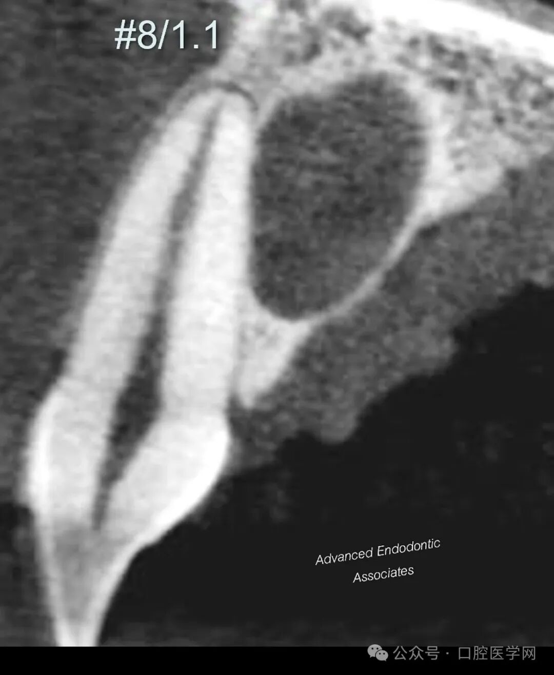 极易误诊！避免被表面现象误导