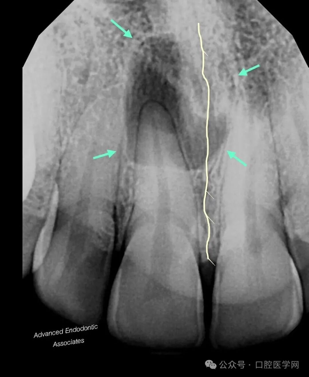 极易误诊！避免被表面现象误导