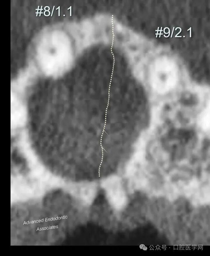 极易误诊！避免被表面现象误导