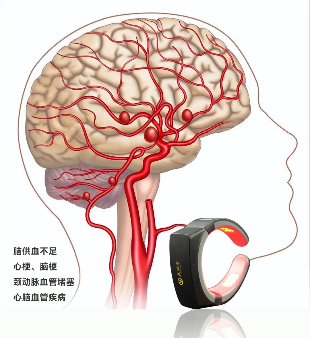 红蓝光治疗仪怎么使用【益·健康】益健堂新款颈部红蓝光治疗仪和半导体激光治疗仪，都有鼻腔导线照射头，管啥用？_https://www.jmylbn.com_新闻资讯_第3张