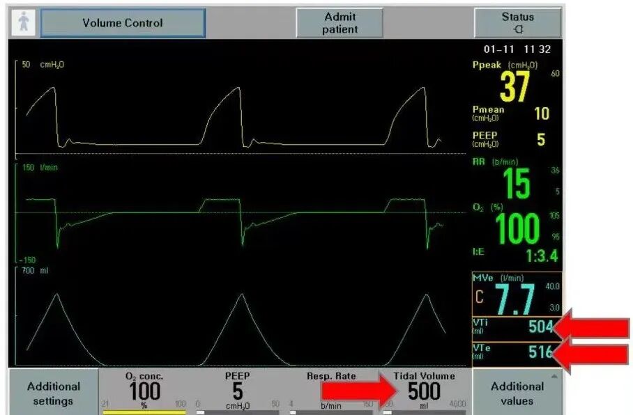 呼吸机ac是什么意思有创呼吸机模式下的参数及其意义_https://www.jmylbn.com_新闻资讯_第1张