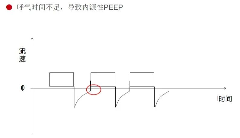 呼吸机ac是什么意思有创呼吸机模式下的参数及其意义_https://www.jmylbn.com_新闻资讯_第2张