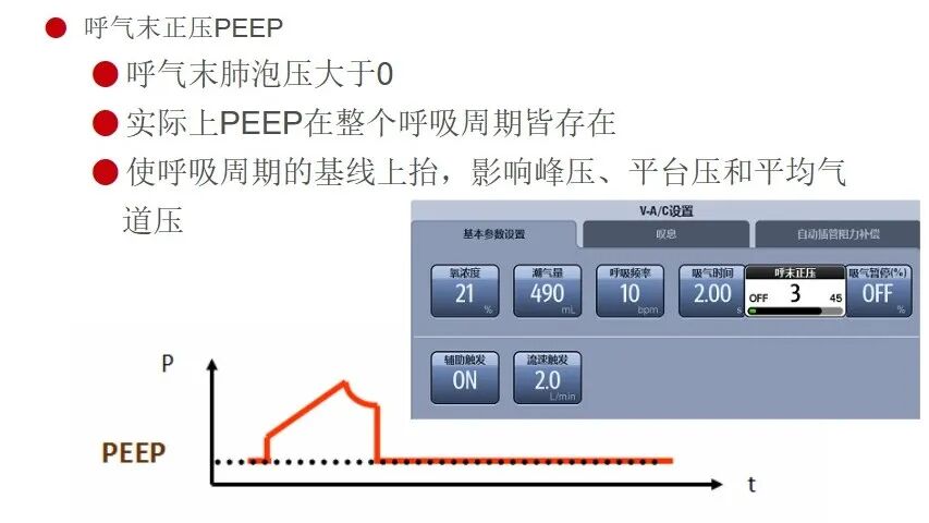 呼吸机ac是什么意思有创呼吸机模式下的参数及其意义_https://www.jmylbn.com_新闻资讯_第6张