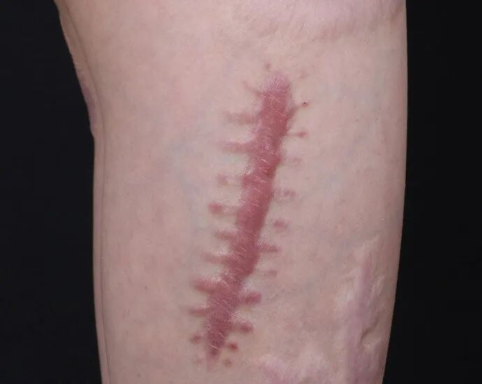 医生为什么缝合不用细线天衣无缝！“医”路相伴，急诊美容缝合对每一个伤口都温柔以待！_https://www.jmylbn.com_新闻资讯_第10张