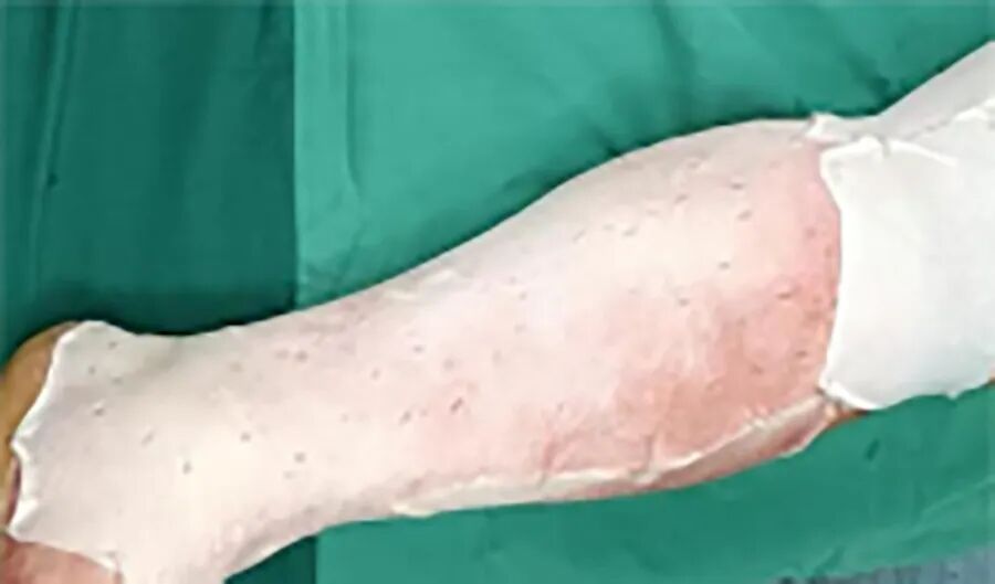 创面修复抗菌敷料怎么用【开诊啦】包头市第四医院（包头市儿童医院）创面修复与烧伤门诊开诊_https://www.jmylbn.com_新闻资讯_第1张