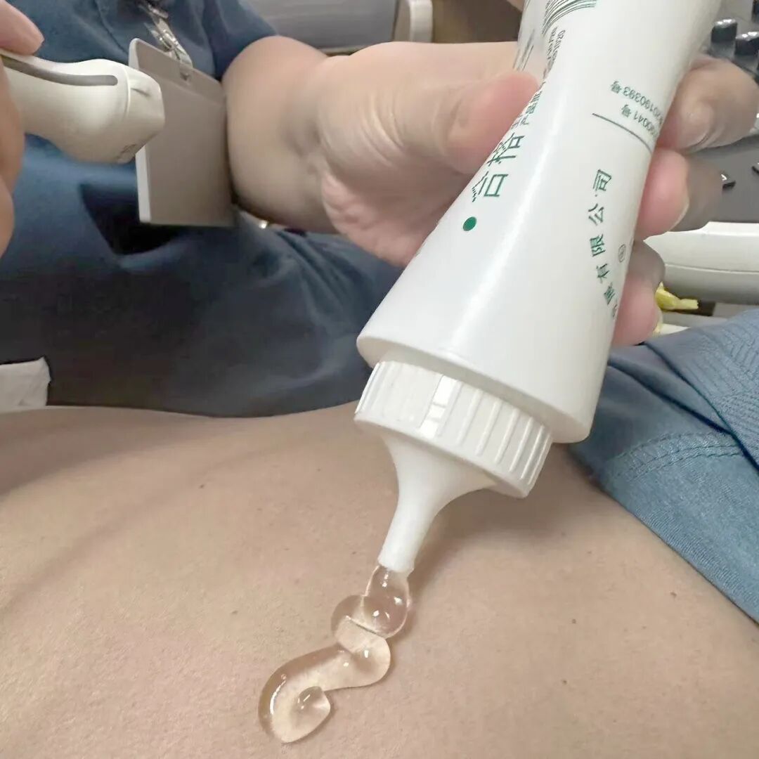 耦合剂怎么加热耦合剂恒温加热器，超声检查不再“冰凉”——宁晋县中西医结合医院为患者冬日送暖_https://www.jmylbn.com_新闻资讯_第5张