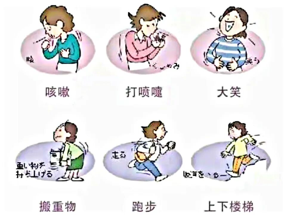 什么是超声容积探头盆底超声检查——让难言之隐不再难查_https://www.jmylbn.com_新闻资讯_第5张