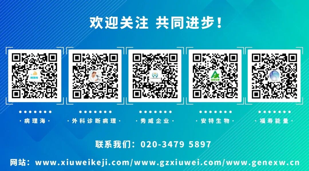 什么是病理蜡块【病理技术分享】精确诊断添利器胸腹水细胞蜡块_https://www.jmylbn.com_新闻资讯_第21张