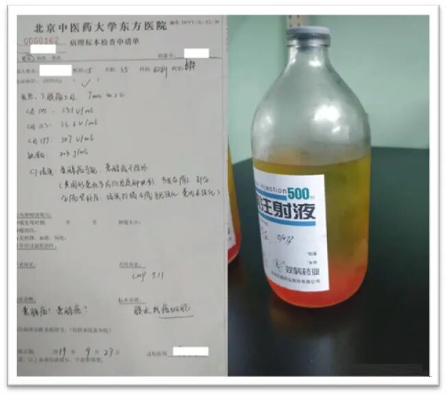 什么是病理蜡块【病理技术分享】精确诊断添利器胸腹水细胞蜡块_https://www.jmylbn.com_新闻资讯_第14张