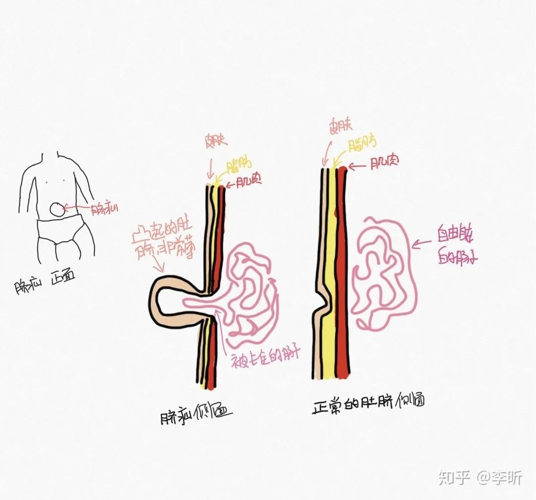 我聽過最糟糕的育兒建議：他還是個孩子 親子 第6張