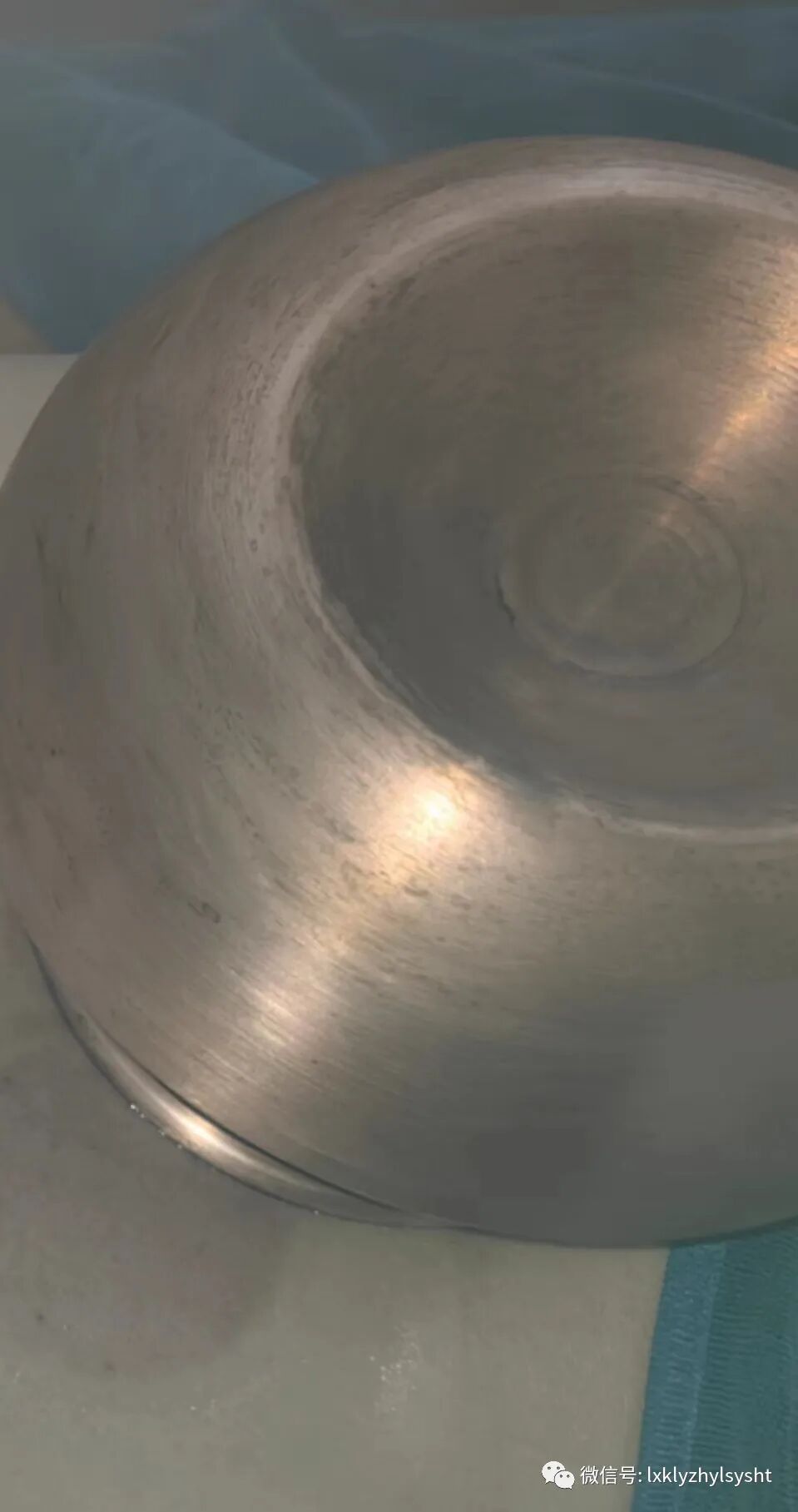 竹火罐怎么用中医绿色疗法       铜火罐中医传统三大疗法之一 火罐疗法（竹罐，铜罐，砭石罐等）_https://www.jmylbn.com_新闻资讯_第2张