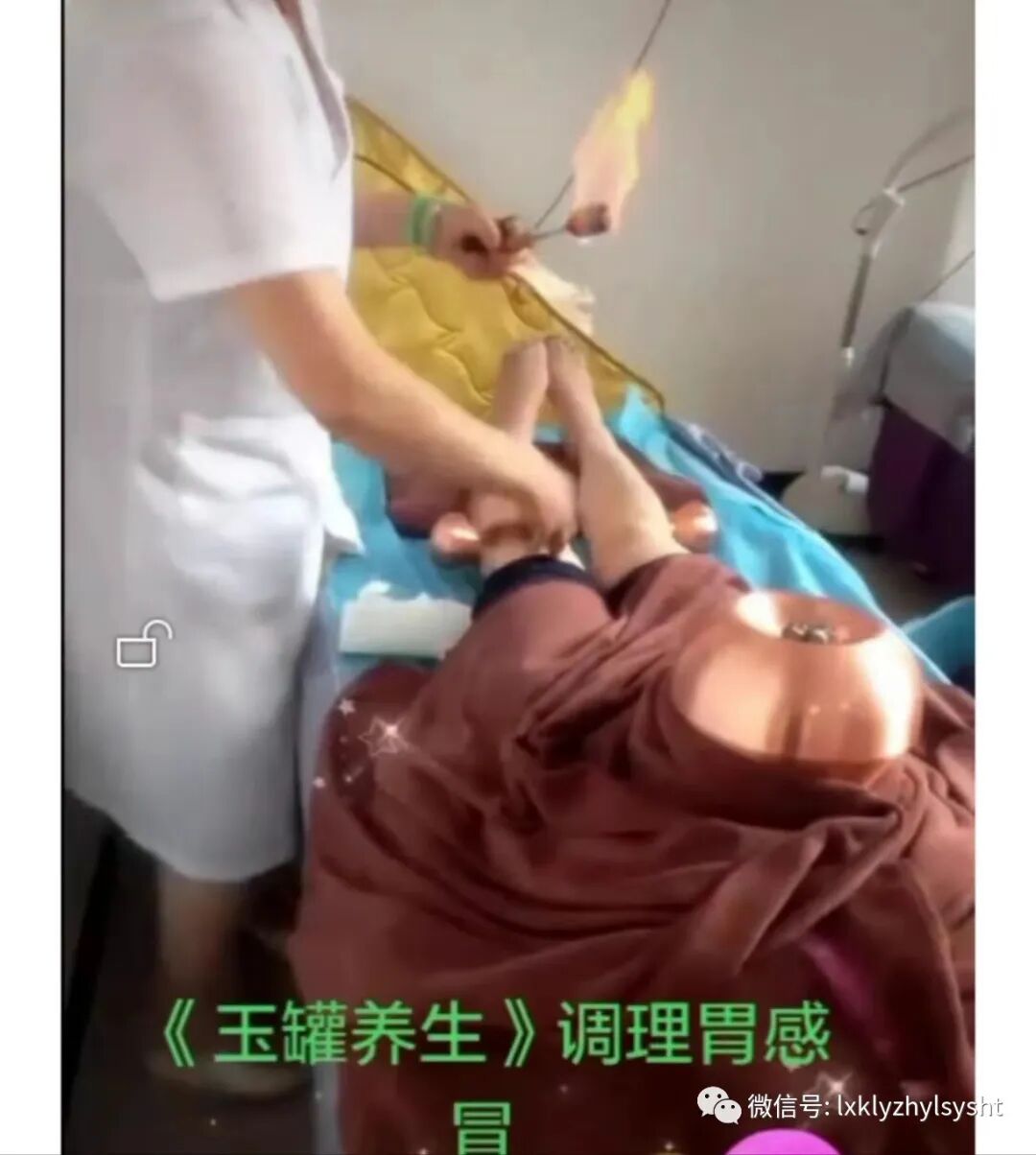 竹火罐怎么用中医绿色疗法       铜火罐中医传统三大疗法之一 火罐疗法（竹罐，铜罐，砭石罐等）_https://www.jmylbn.com_新闻资讯_第1张