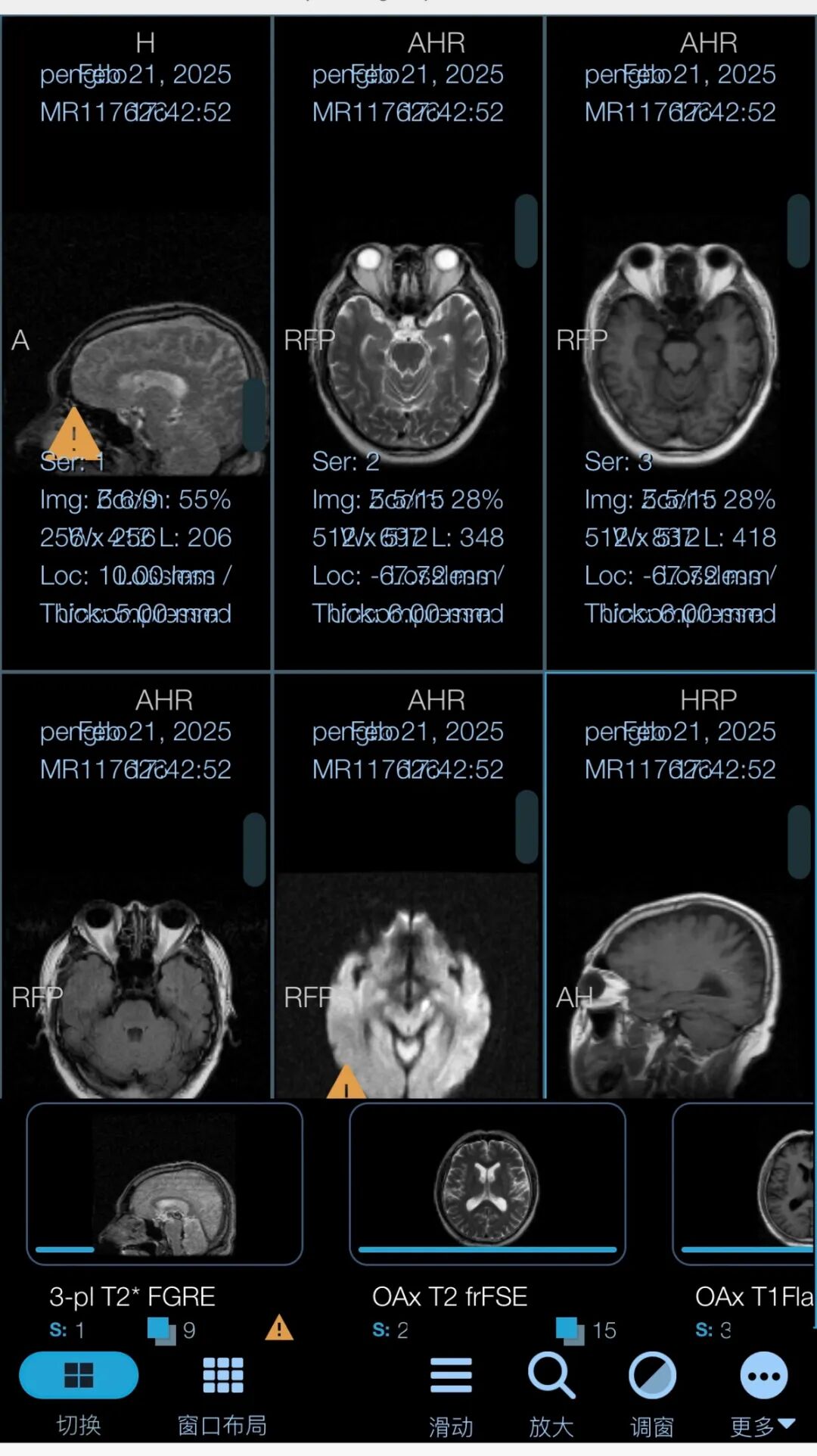 放射科怎么打印便民服务｜放射科“云胶片”上线了，可随时随地查看影像数据_https://www.jmylbn.com_新闻资讯_第10张