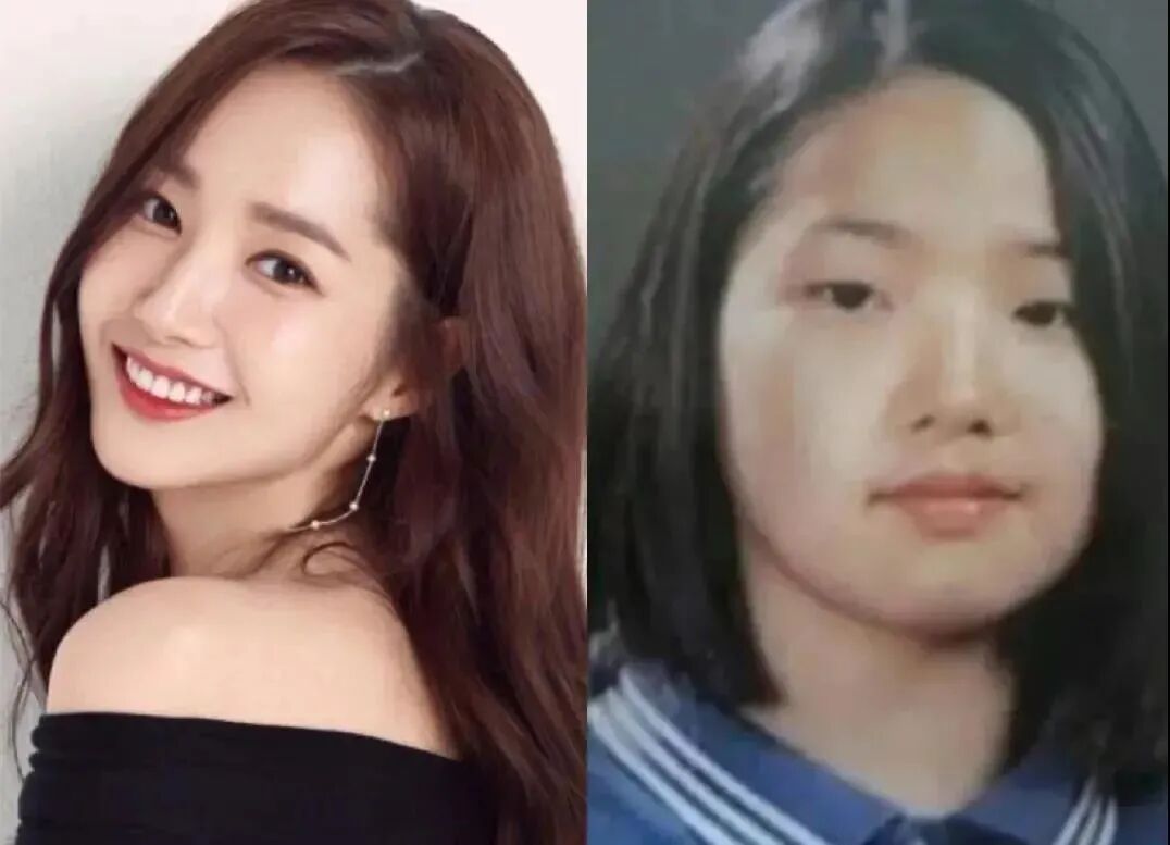 【明星】从16岁国民甜妹到“整容怪物”？她这妈生美貌算是毁了（组图） - 61