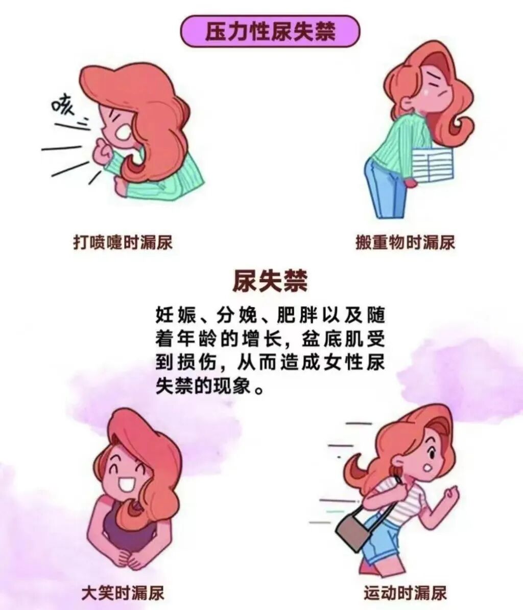 尿道张力过强怎么办【世界尿失禁周】关注尿失禁 远离“社交癌”——泌尿外科开展首例经闭孔无张力尿道中段悬吊带术_https://www.jmylbn.com_新闻资讯_第7张