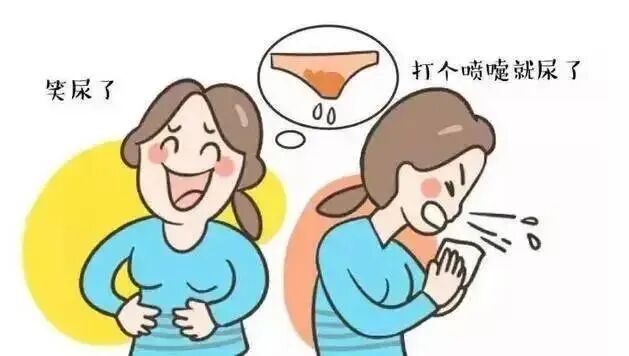 尿道张力过强怎么办【世界尿失禁周】关注尿失禁 远离“社交癌”——泌尿外科开展首例经闭孔无张力尿道中段悬吊带术_https://www.jmylbn.com_新闻资讯_第3张