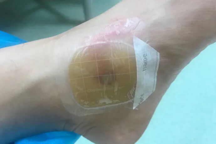 纱布绷带怎么用【健康365】超实用！包扎的正确打开方式，赶紧学起来！_https://www.jmylbn.com_新闻资讯_第31张