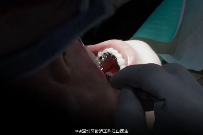 慈恩齿科，正式入驻惠州啦！！！