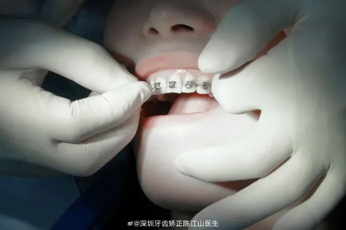 慈恩齿科,正式入驻惠州啦!!! 慈恩齿科,正式入驻惠州啦!!!