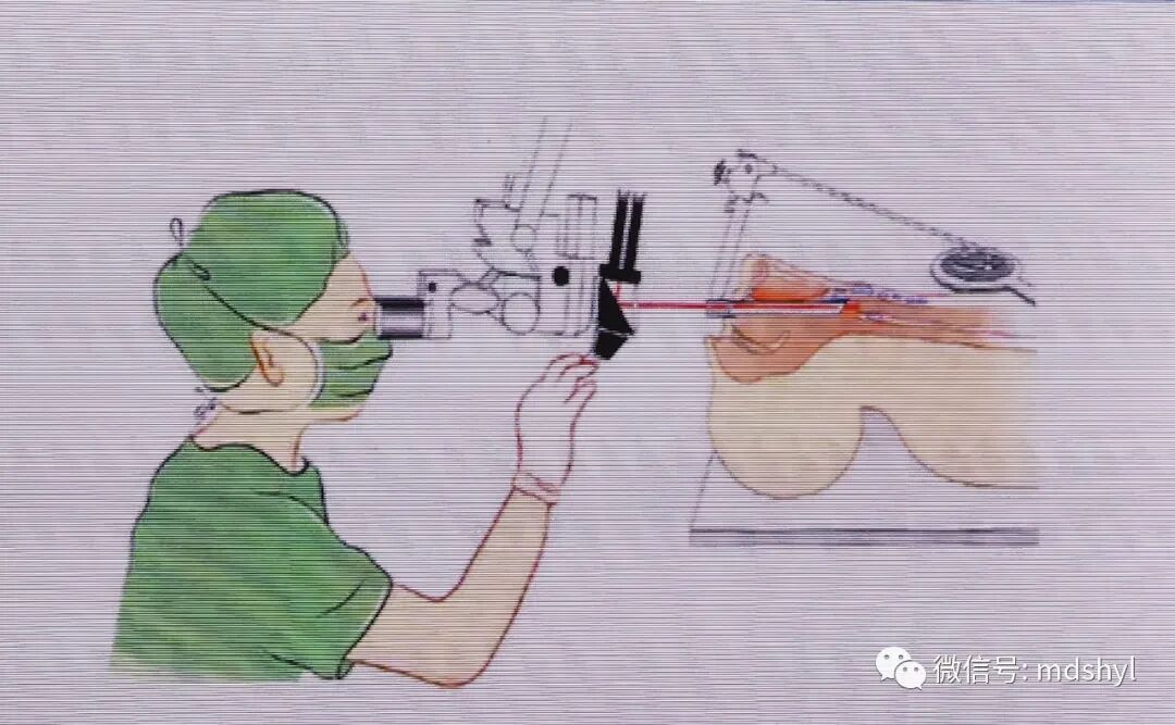 普通喉镜怎么使用如何避免动态电子喉镜误当普通电子喉镜使用？_https://www.jmylbn.com_新闻资讯_第43张