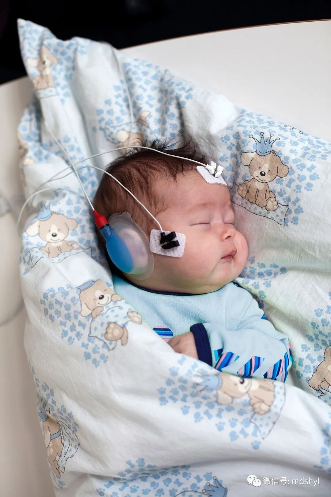 听力筛查仪怎么看国产听力筛查仪TE／DP／AABR系列_https://www.jmylbn.com_新闻资讯_第17张