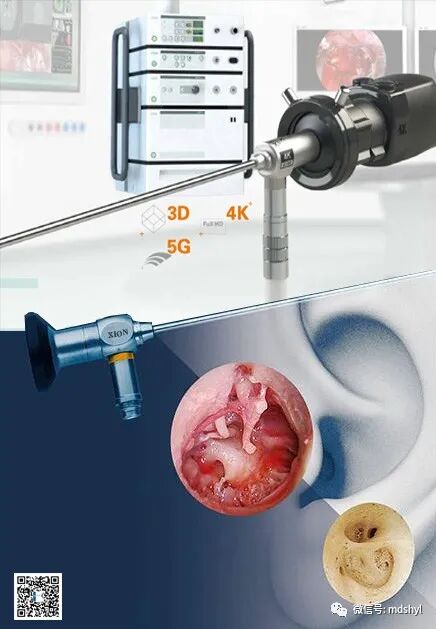 耳鼻喉治疗台怎么消毒麦迪生医疗‖耳鼻喉科相关常用高值耗材大全_https://www.jmylbn.com_新闻资讯_第62张