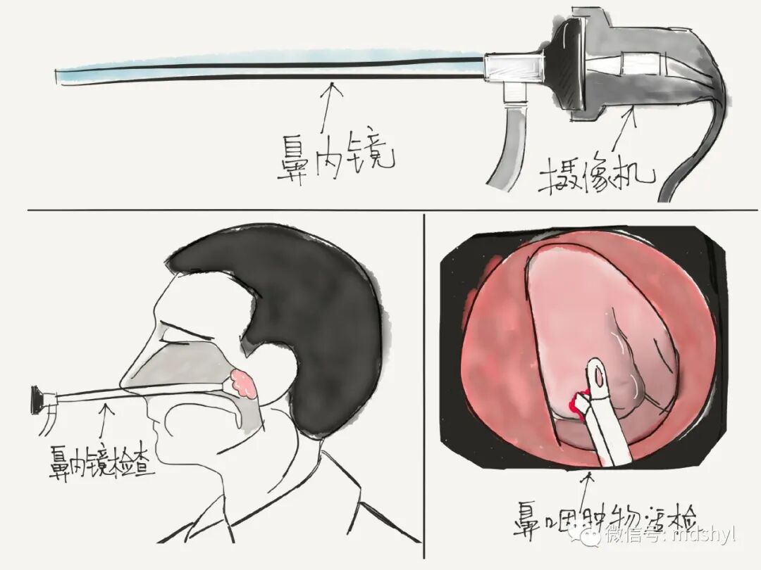 普通喉镜怎么使用如何避免动态电子喉镜误当普通电子喉镜使用？_https://www.jmylbn.com_新闻资讯_第14张