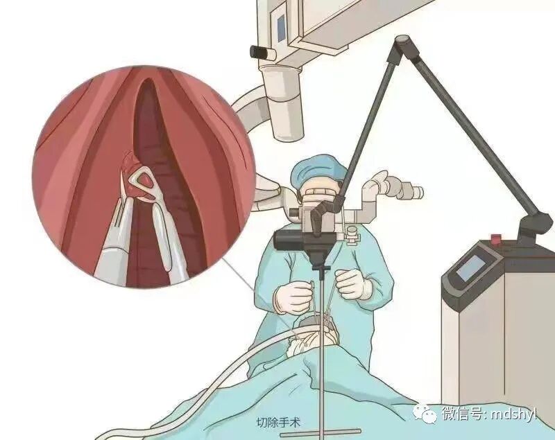 普通喉镜怎么使用如何避免动态电子喉镜误当普通电子喉镜使用？_https://www.jmylbn.com_新闻资讯_第42张