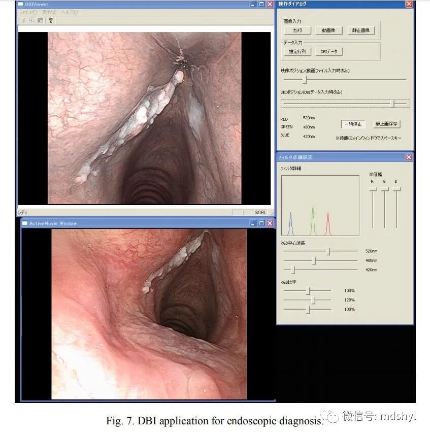 普通喉镜怎么使用如何避免动态电子喉镜误当普通电子喉镜使用？_https://www.jmylbn.com_新闻资讯_第25张