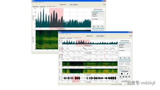 普通喉镜怎么使用如何避免动态电子喉镜误当普通电子喉镜使用？_https://www.jmylbn.com_新闻资讯_第33张