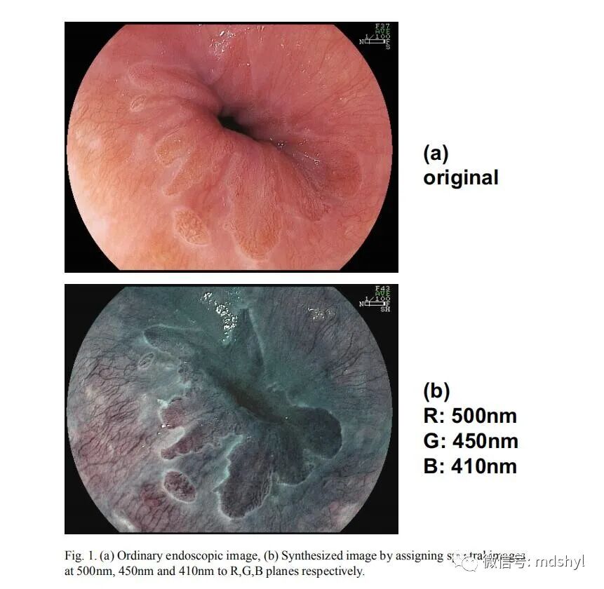 普通喉镜怎么使用如何避免动态电子喉镜误当普通电子喉镜使用？_https://www.jmylbn.com_新闻资讯_第26张