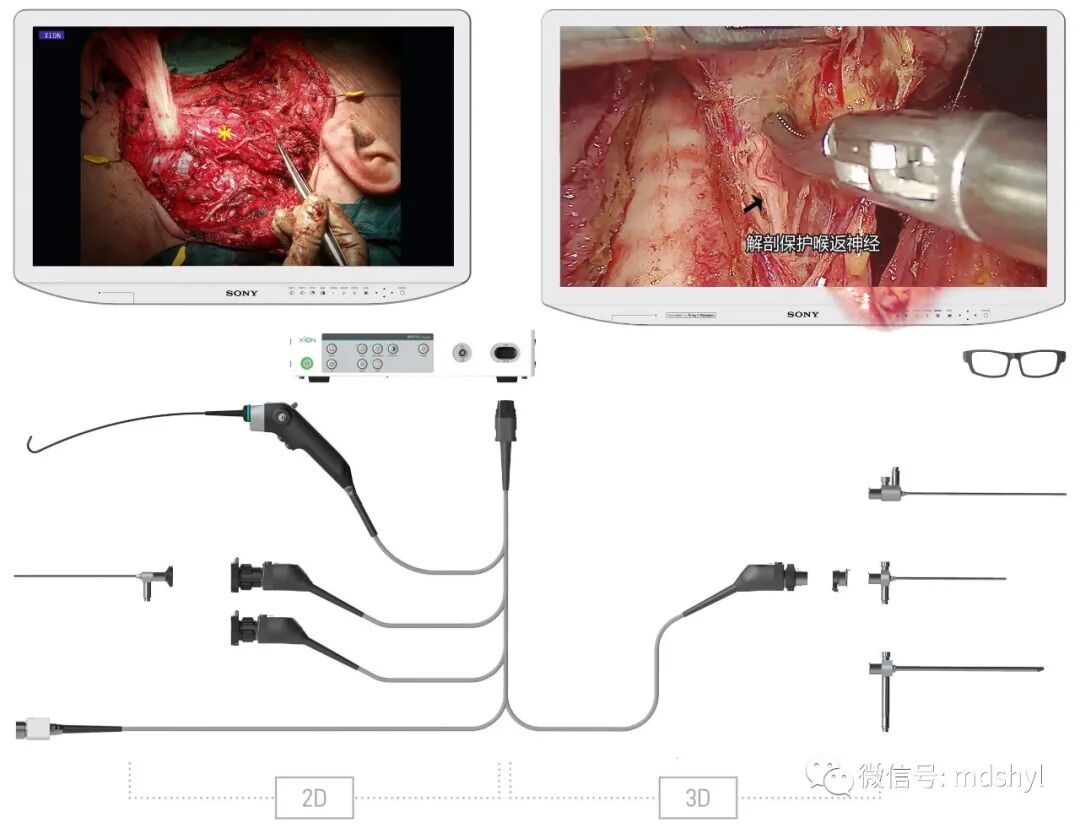 腹腔镜都有什么品牌德国艾克松XION｜｜超高清3D／4K腹腔镜系统_https://www.jmylbn.com_新闻资讯_第15张