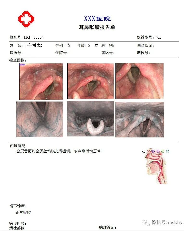 普通喉镜怎么使用如何避免动态电子喉镜误当普通电子喉镜使用？_https://www.jmylbn.com_新闻资讯_第39张